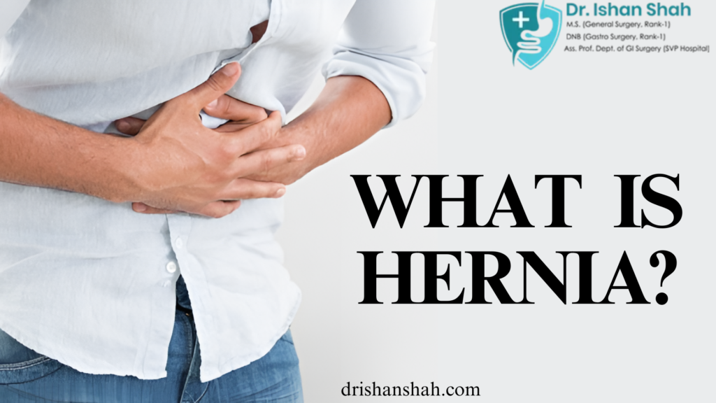 Hernia Doctor in Ahmedabad