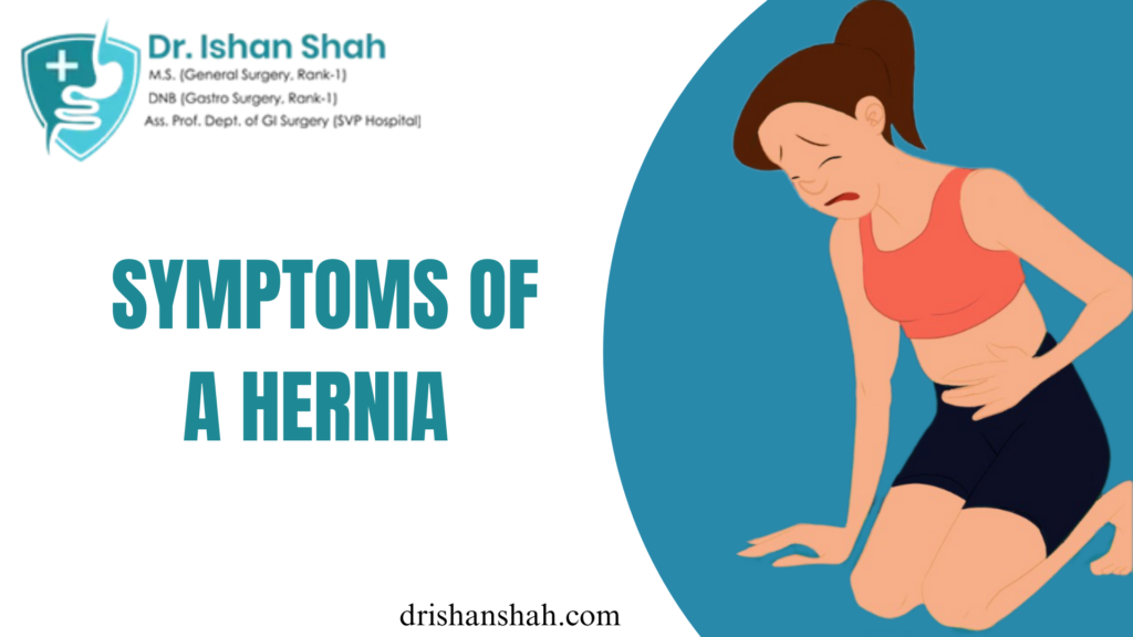 Symptoms of a Hernia​