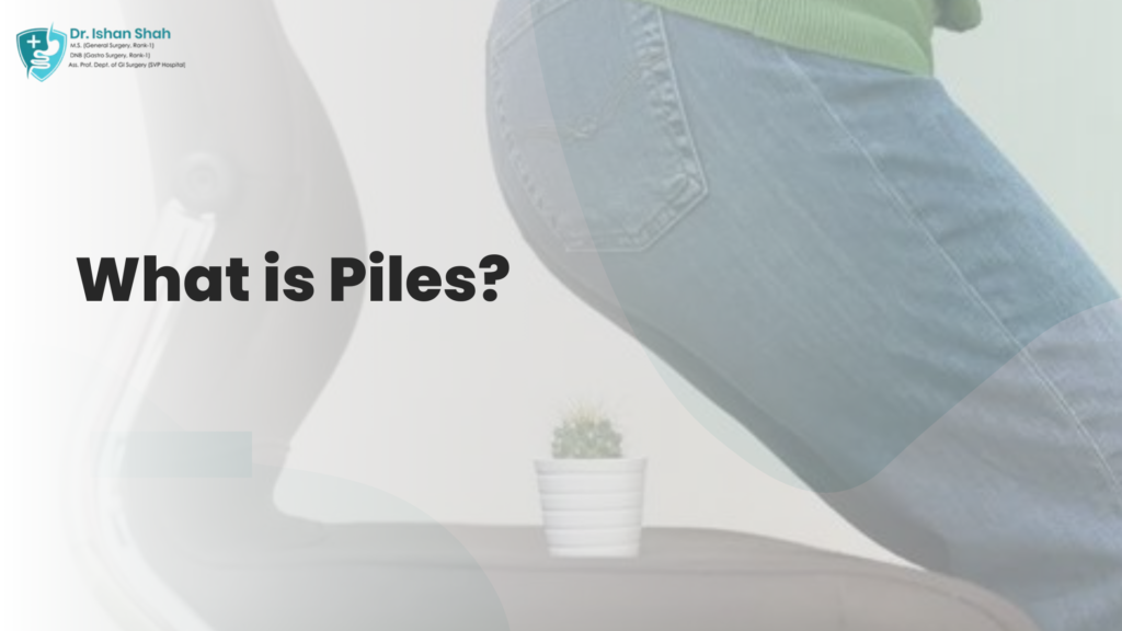 What is Piles