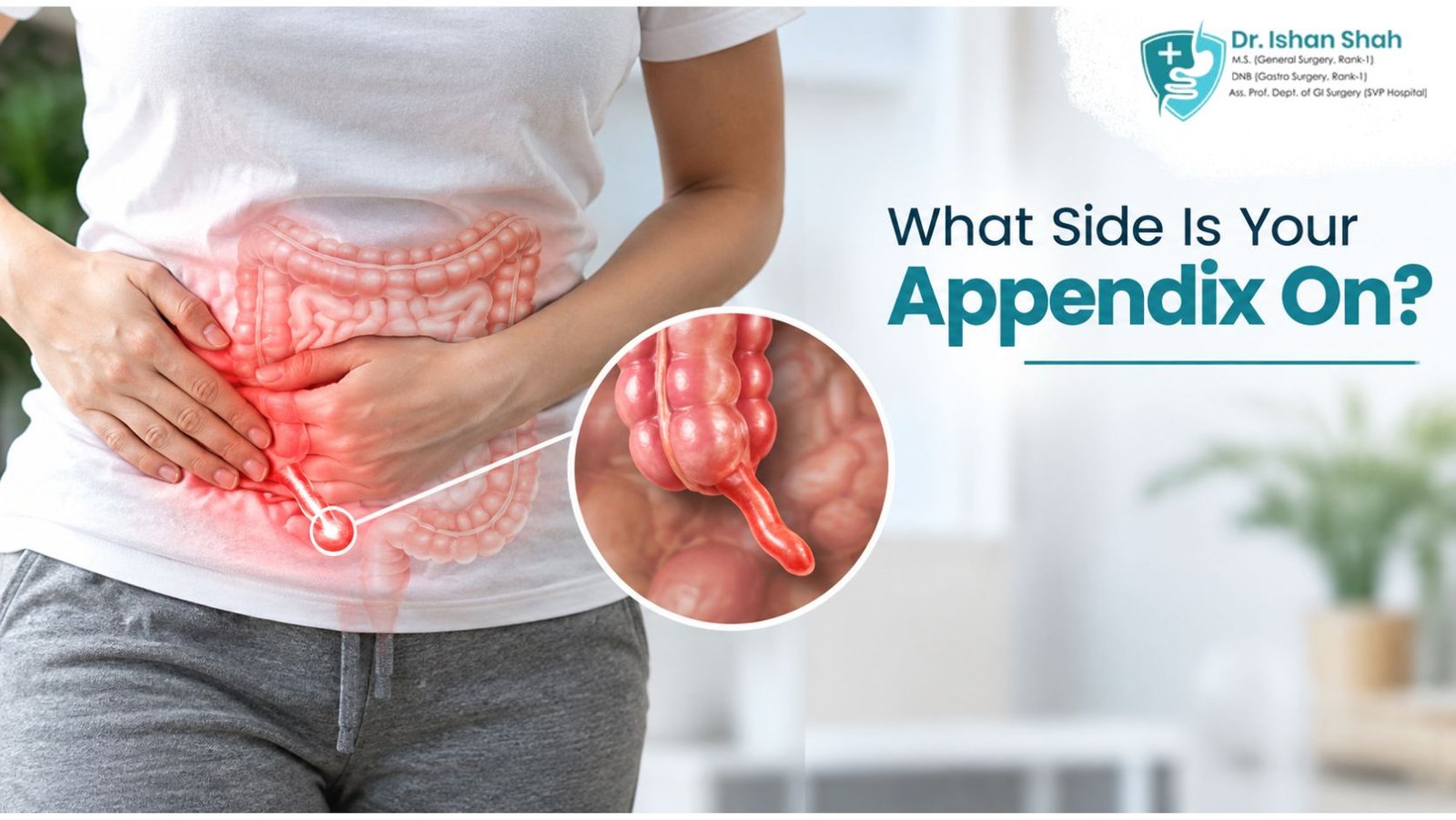 What Side Is Your Appendix On?​