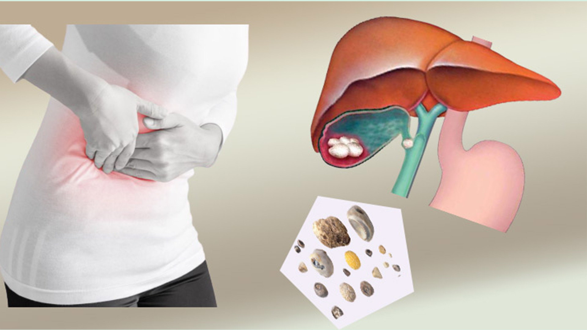 gallbladder stone removal treatment in Ahmedabad