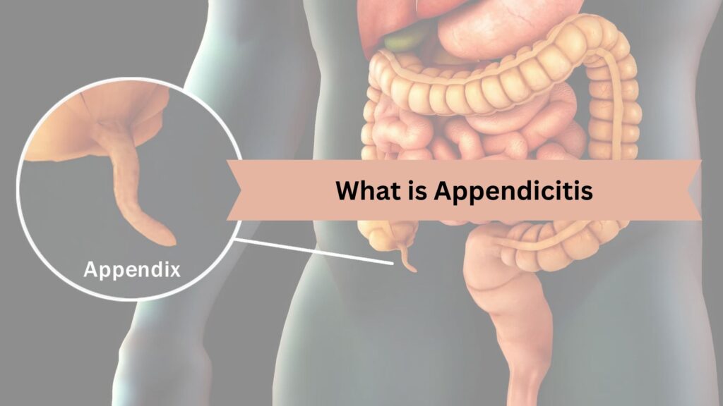 appendix surgeon in Ahmedabad