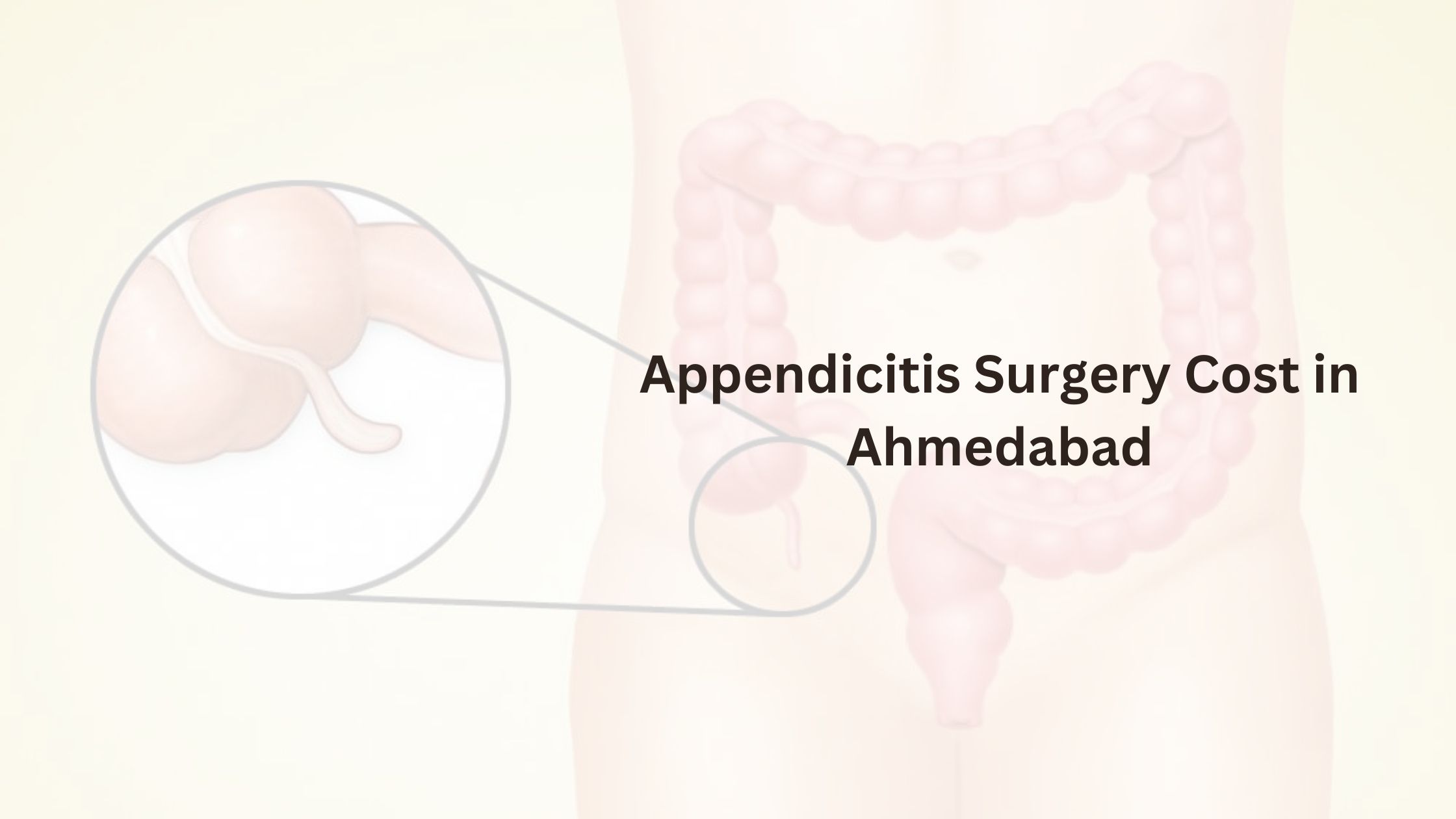 Appendicitis Surgery Cost in Ahmedabad