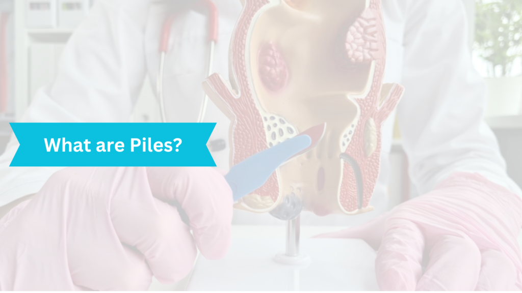 What are Piles?​