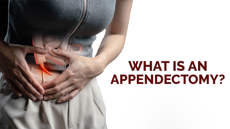 What Is an Appendectomy?