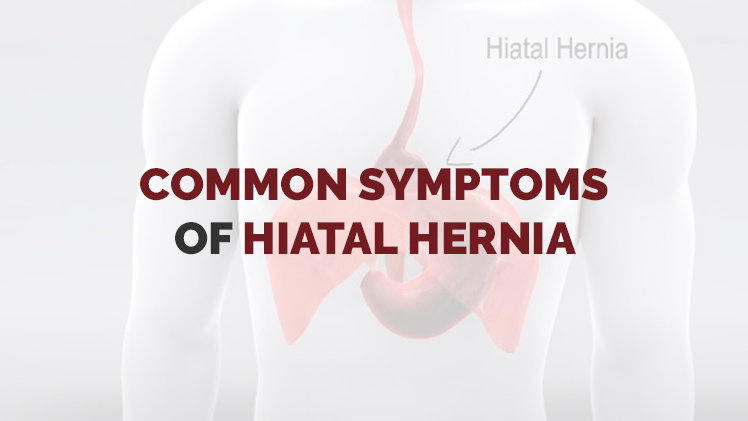 Common Symptoms of Hiatal Hernia