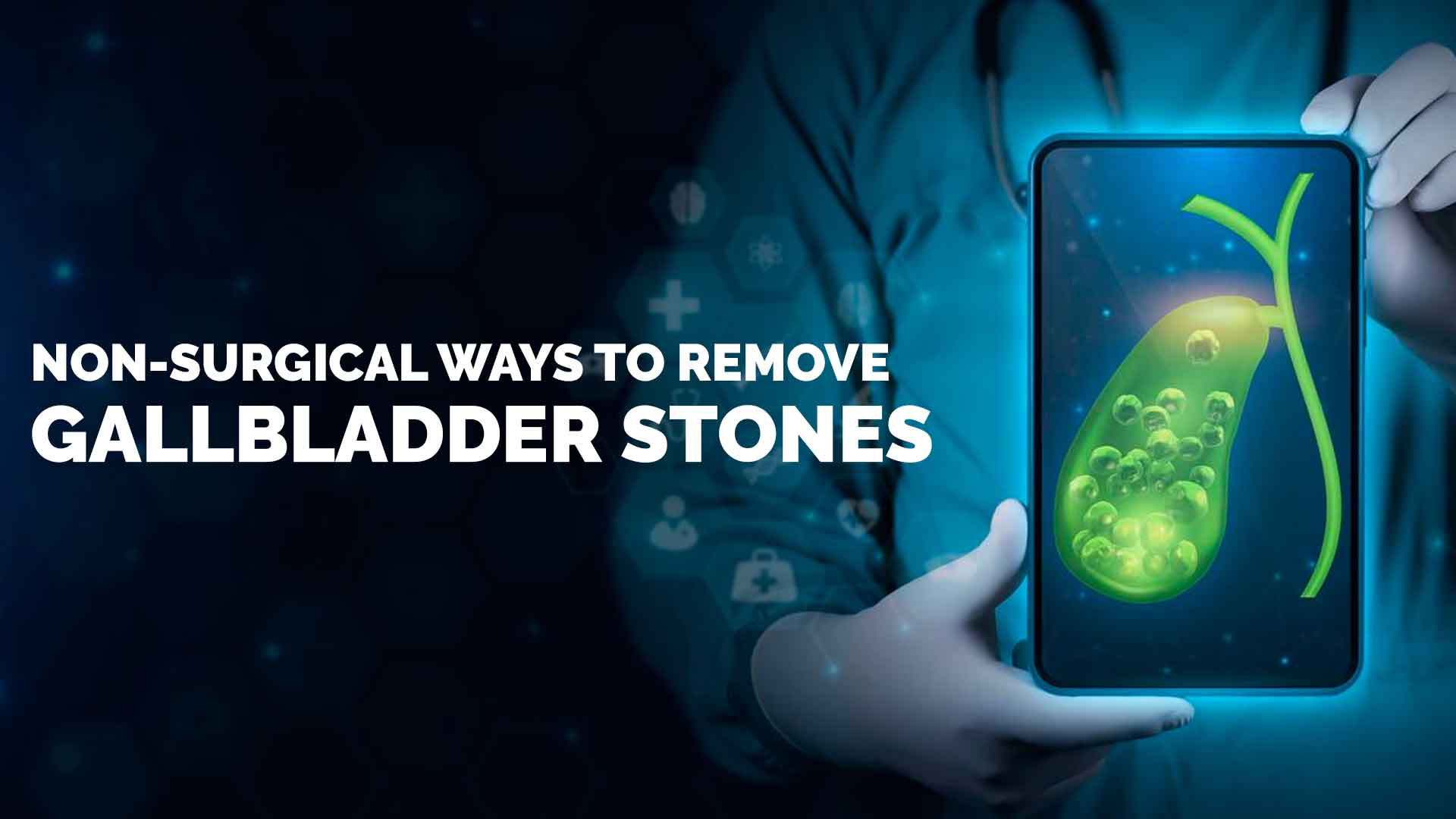 Non-Surgical Ways to Remove Gallbladder Stones