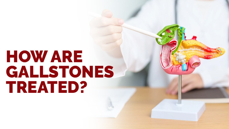 How Are Gallstones Treated?