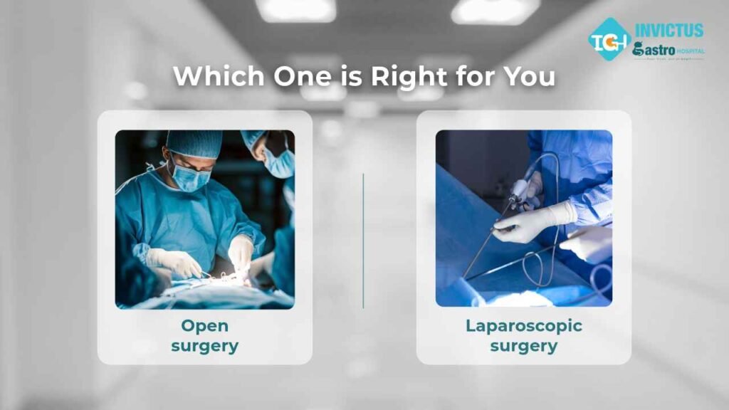 Open Surgery vs. Laparoscopic Surgery: What’s Better for You?