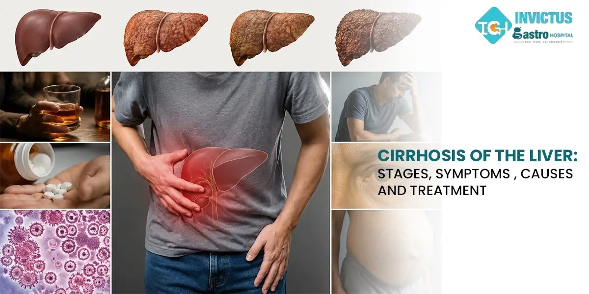liver cirrhosis its stages symptoms causes and treatment